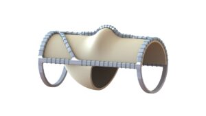VenoValve first-in-human