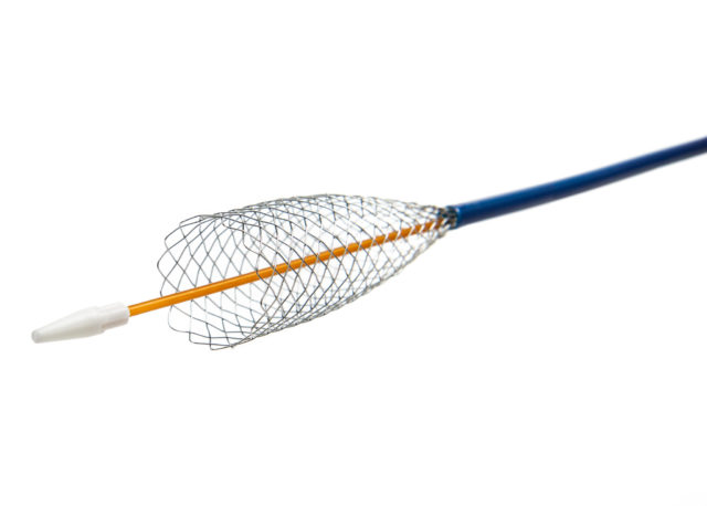 First-in-man usage of blueflow venous stent - Venous News