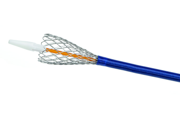 Four-month follow-up for first procedures using blueflow Venous Stent