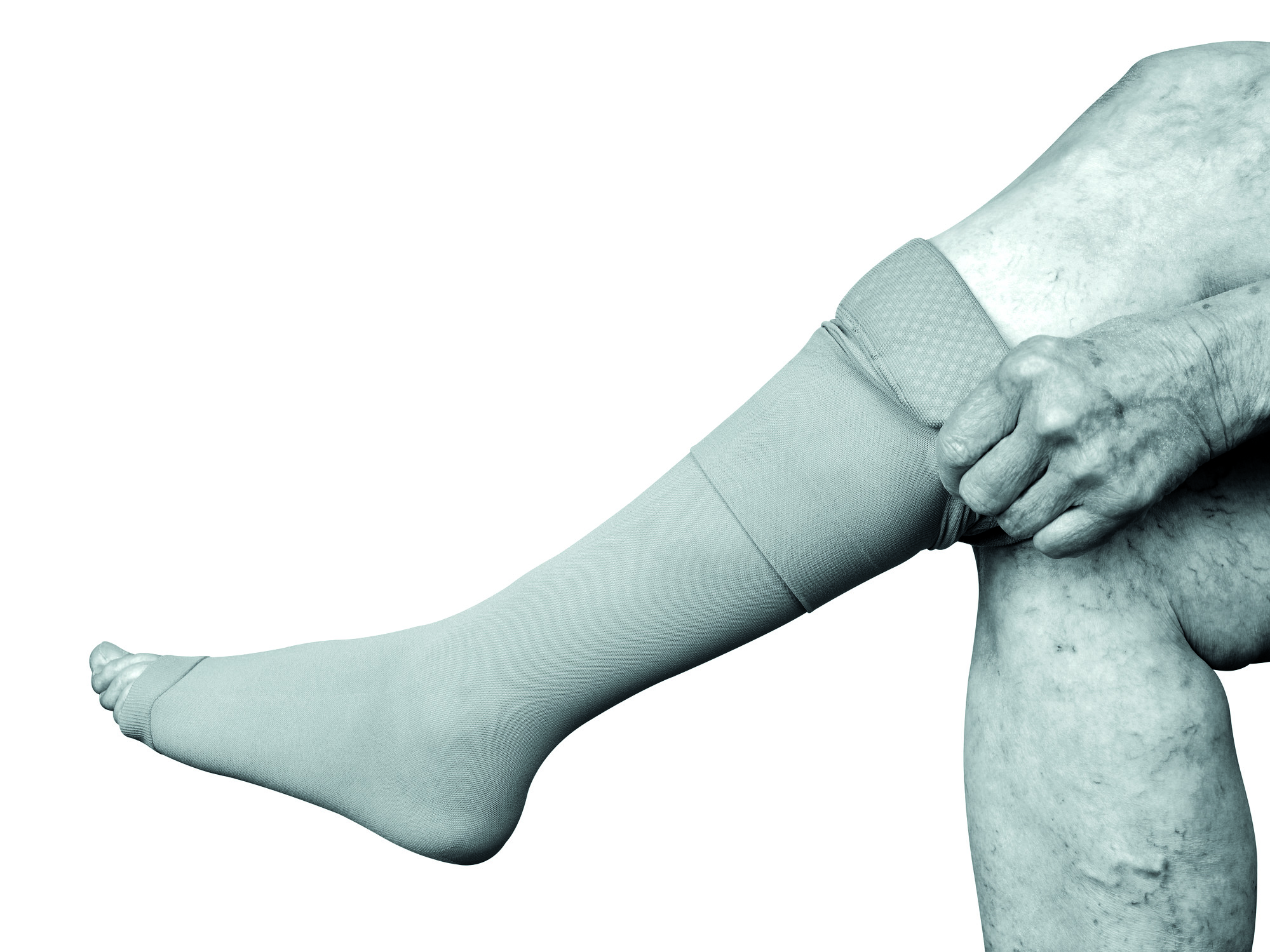 Compression garments that do not compress the foot and heel area may  improve treatment adherence, study finds