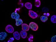 Human colorectal cancer cells