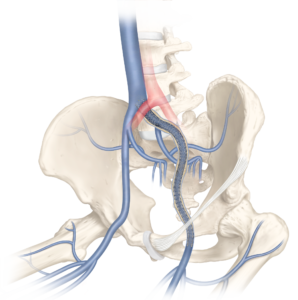 “Excellent outcomes” for Zilver Vena® sustained out to three years in ...