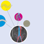 Venous stents web