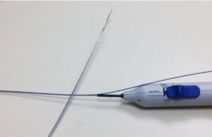 Intravenous anaesthesia delivery during varicose vein treatment proves safe and reduces pain scores, researcher reports anesthesia