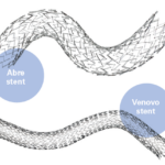 Abre and Venovo stents