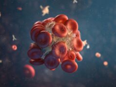 Large administrative databases enter crosshairs as comparative analysis shows percutaneous mechanical thrombectomy as superior to CDT for acute PE analysis