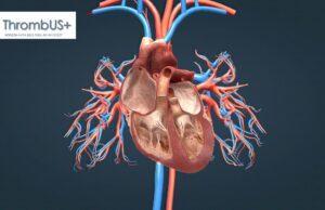EU project develops portable diagnostic device for the early detection of deep vein thrombosis