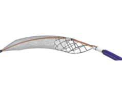 Inari Medical updates ClotTriever XL IFU amid US FDA recall notice