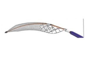 Inari Medical updates ClotTriever XL IFU amid US FDA recall notice