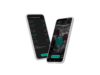 US FDA clears ThinkSono’s ultrasound AI software for deep vein thrombosis