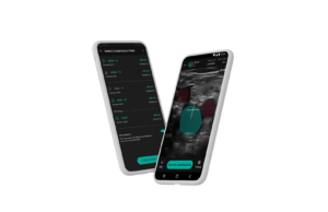 Novel AI-assisted DVT diagnostic pathway aims to “democratise” point-of-care ultrasound