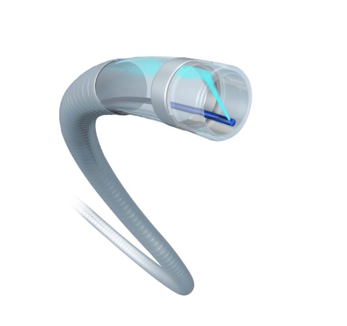 JETi registry reports effective thrombus reduction in lower extremity DVT