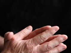 Study reveals elevated VTE risk in patients with rheumatoid arthritis venous thromboembolism