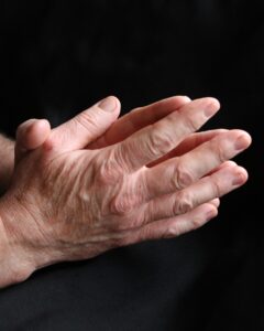 venous thromboembolism