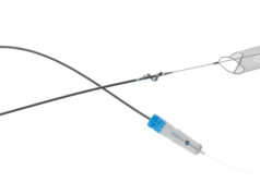 InterVene receives US FDA 510(k) clearance for Recana thrombectomy system