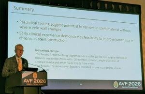 Recana thrombectomy system shows early promise in treatment of in-stent restenosis