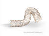 MDR approval granted for Gore’s Fortegra venous stent