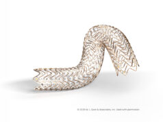 MDR approval granted for Gore’s Fortegra venous stent