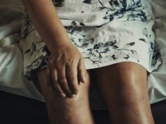 Systematic review deems microsurgical treatment “safe, effective and durable” for lower-extremity lymphoedema prevention lymphoedema