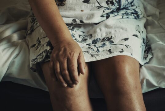 Systematic review deems microsurgical treatment “safe, effective and durable” for lower-extremity lymphoedema prevention lymphoedema